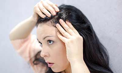 Dandruff Treatment